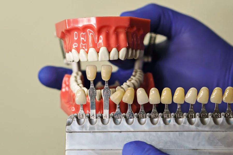 You are currently viewing What to Know Before Choosing Dental Veneers for Your Teeth