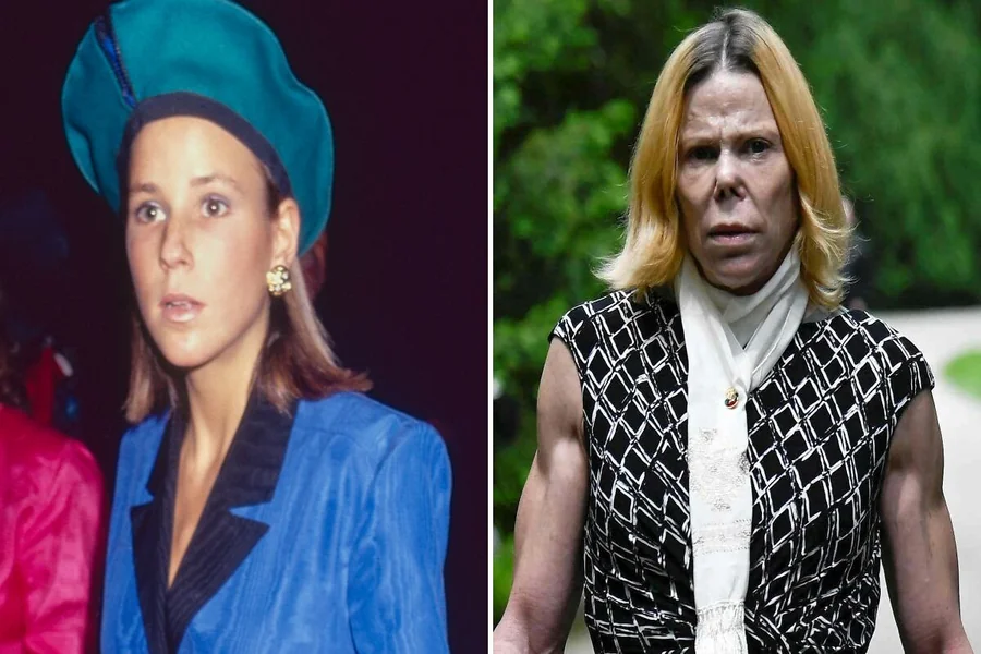 You are currently viewing Celebrity Transformations That Surprised Everyone
