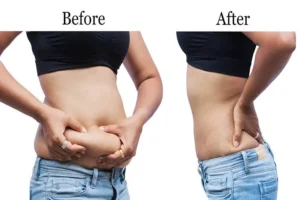 Read more about the article Best Guide to Tirzepatide Weight Loss for Lasting Progress